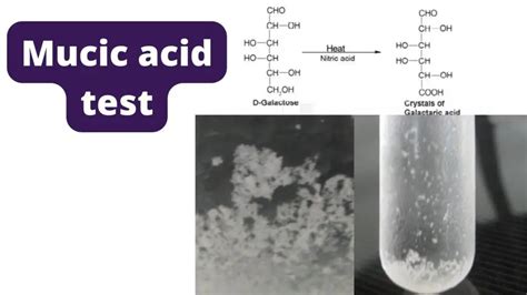 mucic acid test principle